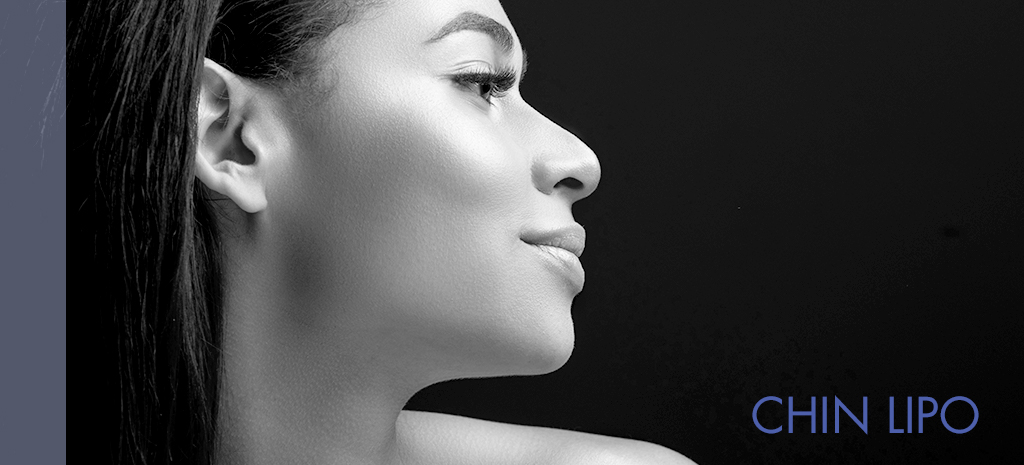 Chin Liposuction Atlanta