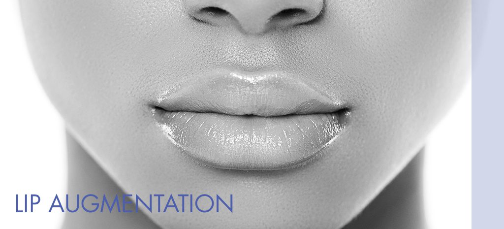 Lip Augmentation Atlanta