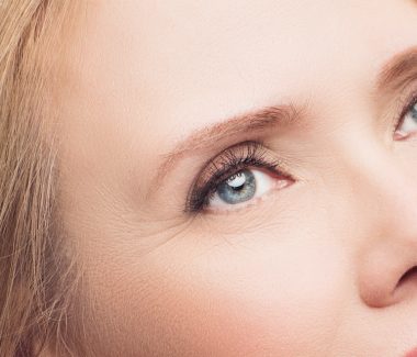 Forehead/Browlift