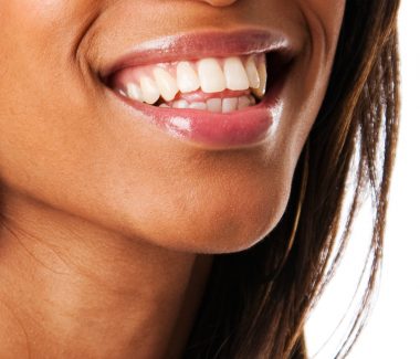 Chin Implant