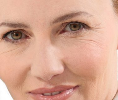 Liquid Facelift