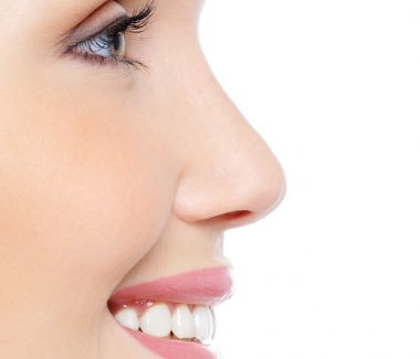 Rhinoplasty (Nose Job)