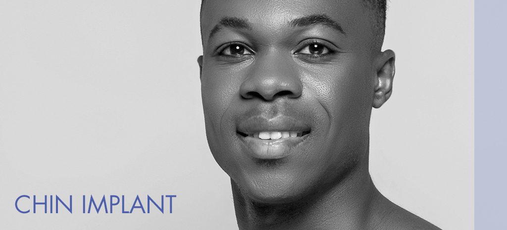 Chin Implant Men Atlanta