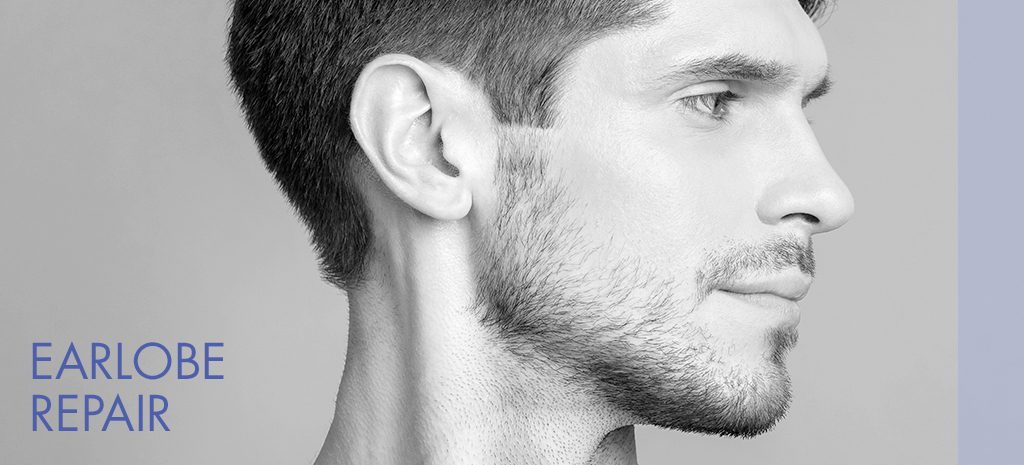Earlobe Repair Men Atlanta