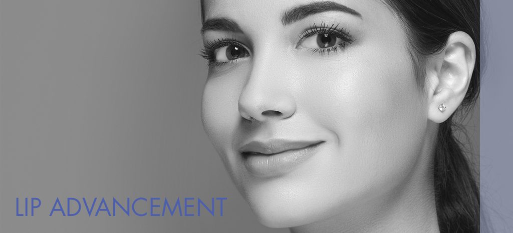 Lip Advancement Atlanta