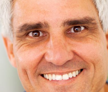 Botox® for Men