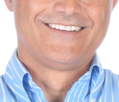 Chin Liposuction for Men