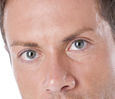 Eyelid Lift for Men