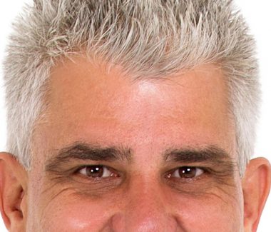 Hair Restoration & Rejuvenation for Men