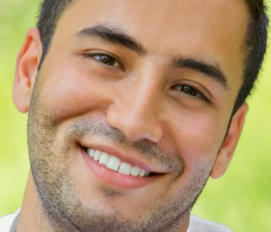 Otoplasty For Men