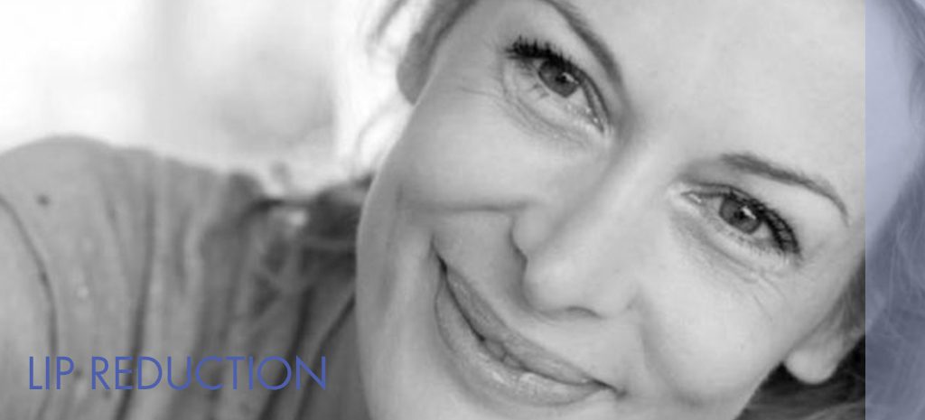 Lip Reduction Atlanta