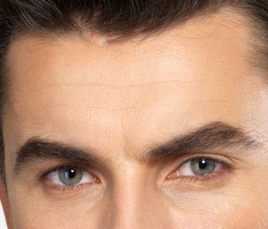 Forehead Lift for Men