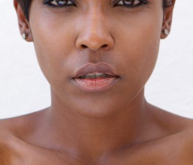 Microneedling