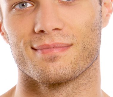 Lip Advancement for Men