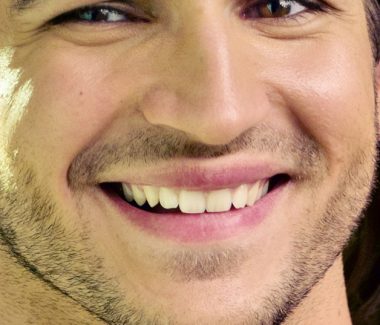 Lip Lift for Men