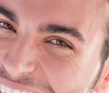 Men’s Lower Eyelid Lift