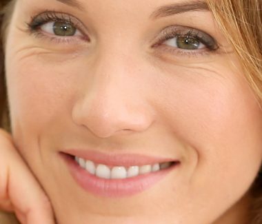 Fractional Laser Resurfacing