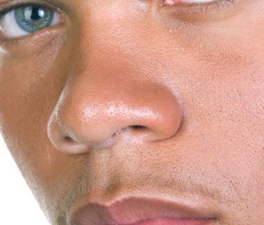 Non-Surgical Rhinoplasty for Men