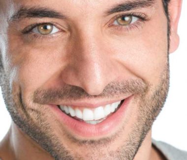 Signature PrecisionLift™ – Laser Facelift for Men