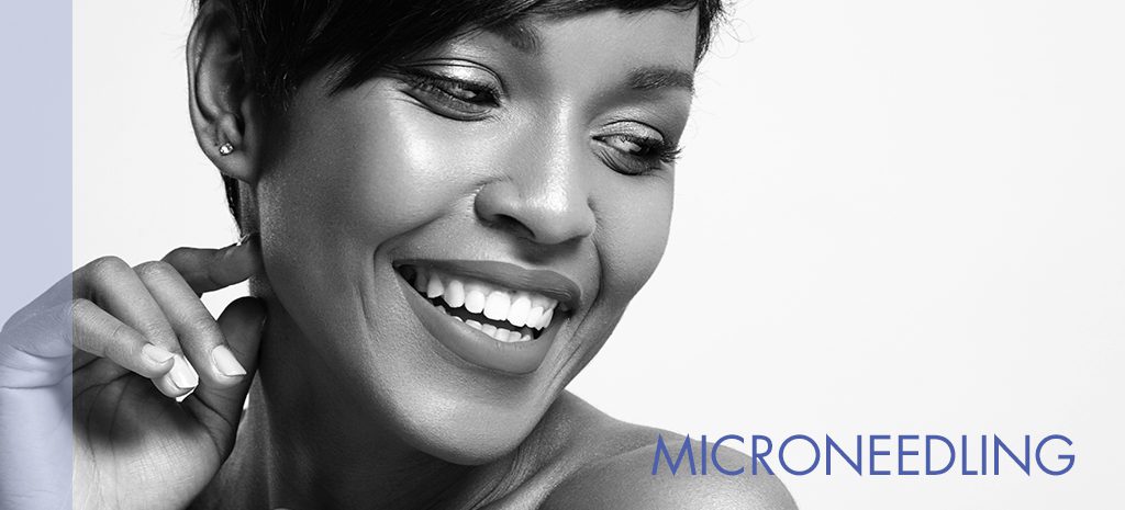Microneedling Atlanta