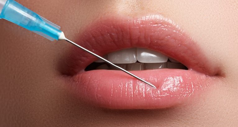 Woman Receiving Lip Injectable