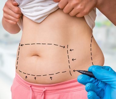 Get Your Mojo Back with a Mommy Makeover