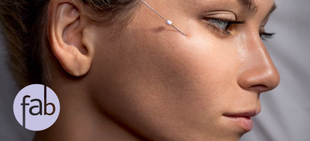 What Happens After a Facelift?