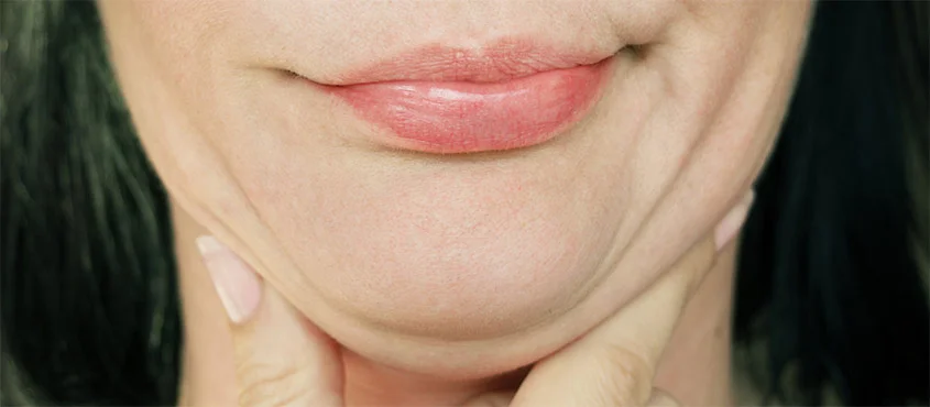 What causes double chins