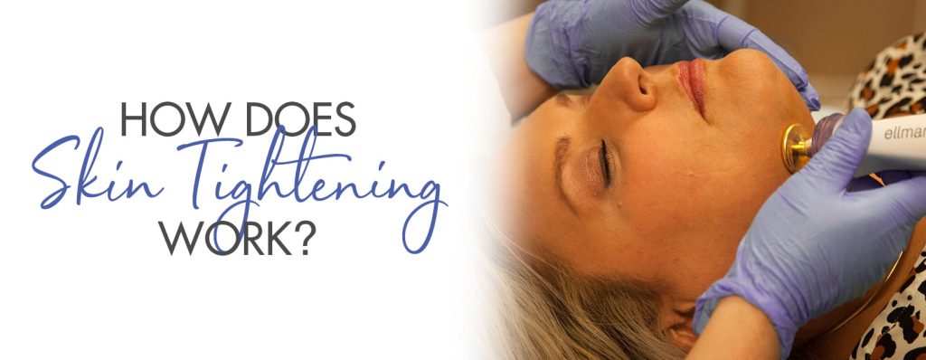 skin tightening