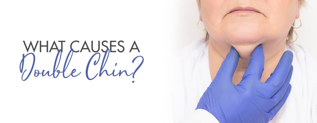 what causes a double chin