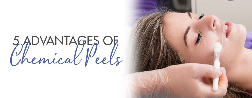 chemical peels