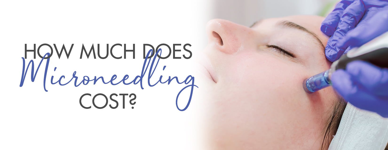 Microneedling Cost Near Me