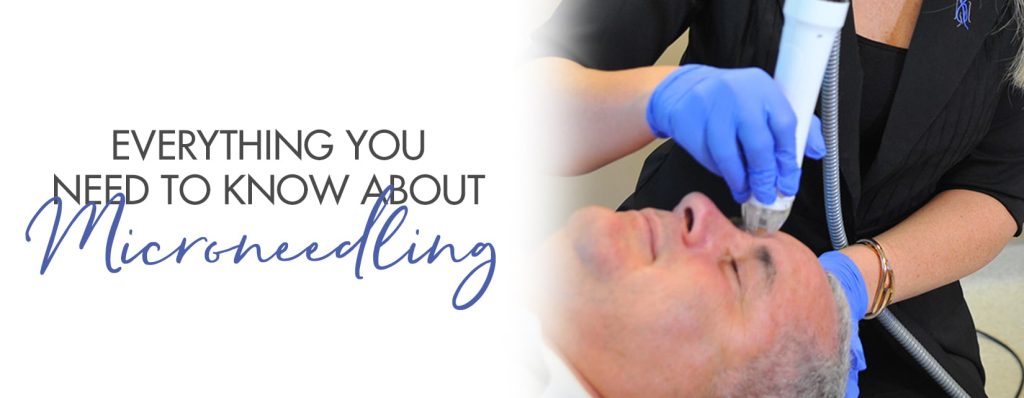 microneedling