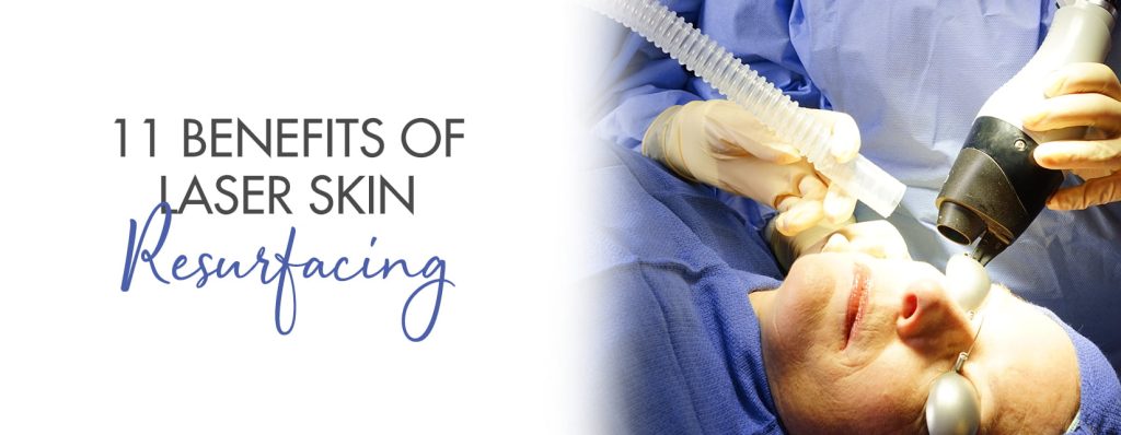 Benefits of Laser Skin Resurfacing