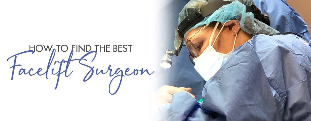 facelift surgeon