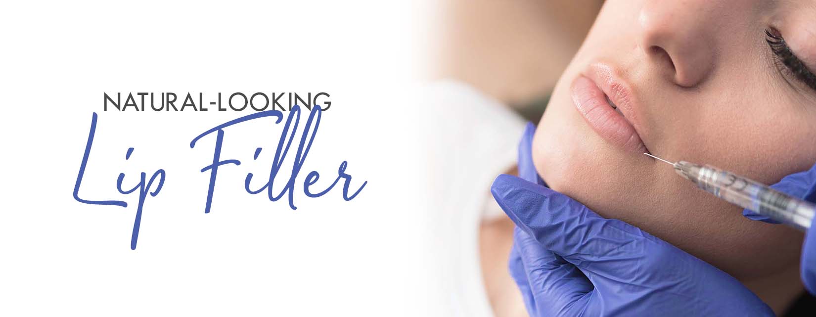 How to Ask Your Plastic Surgeon for Natural Looking Lip Fillers in