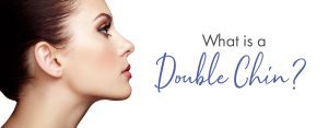 double chin