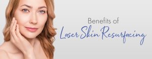 laser skin resurfacing
