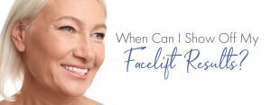 facelift results