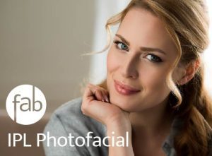 Woman depicting patient for IPL Treatment.