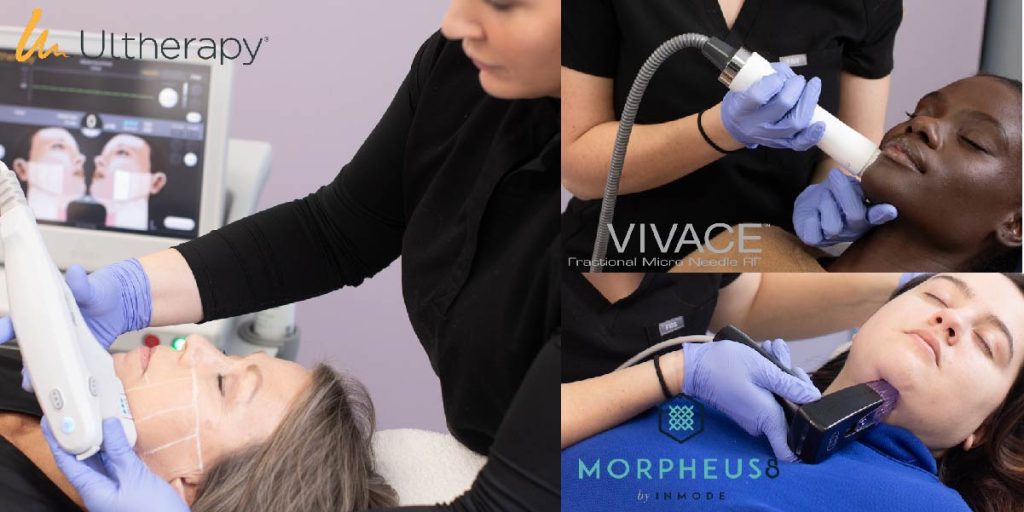 Skin Tightening treatment options at Atlanta Face and Body, Vinings, Georgia.