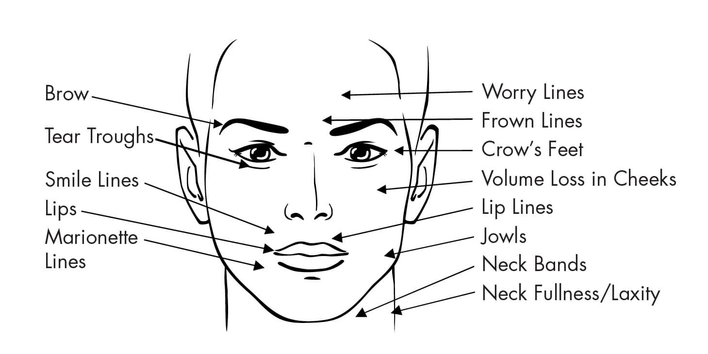 ¿Soy candidato para un lifting facial?