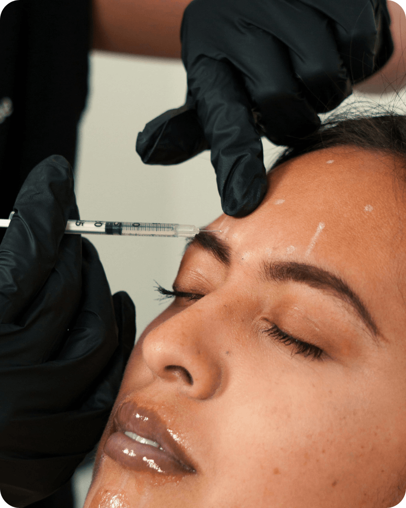 Botox Injections