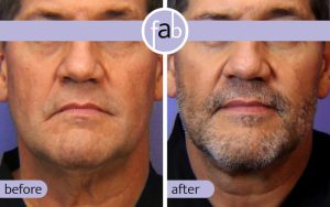 doctor-elizabeth-atlanta-face-beauty