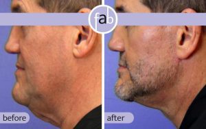 doctor-elizabeth-atlanta-face-beauty