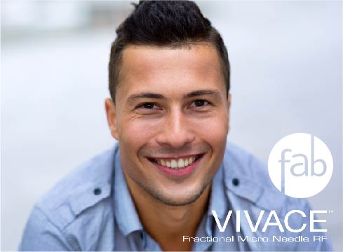 atlanta-facelife-surgery-vivace-microneedling-men