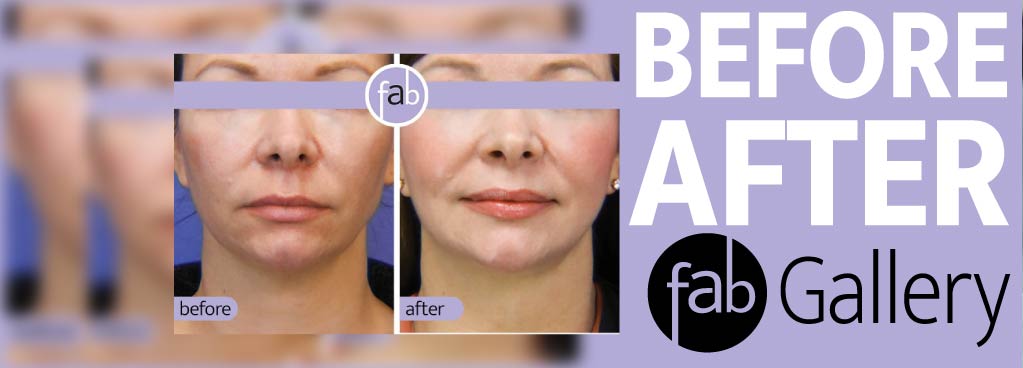 Before & After Gallery