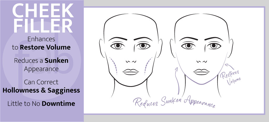 Cheek Filler Infograph