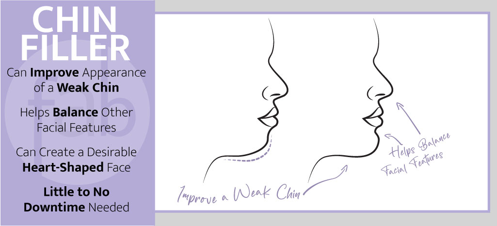 Chin Filler Infograph