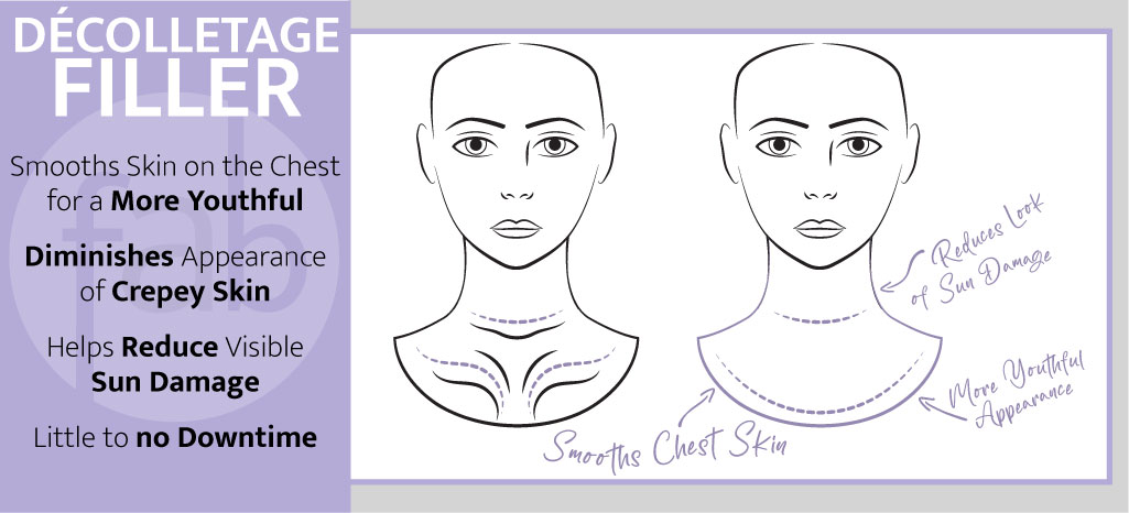 Décolletage Filler Infograph